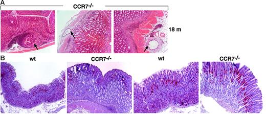 Figure 7. Profound hyperplasia and increased rate of mucosal proliferation in CCR7−/− mice. (A) In some CCR7-deficient mice the thickened fundic mucosa exhibited multiple diverticula (marked by arrows) beneath the muscularis mucosa or even in the subserosa. Diverticula penetrating the muscularis mucosa were also observed. Three representative examples are shown for mice older than 18 months. Magnification, ×100. HE staining in paraffin-embedded sections. (B) Analysis of cellular proliferation in gastric mucosa from wt controls and in CCR7−/− mice. Determination of DNA synthesis rates was assessed by immunohistochemical detection of BrdU incorporation. Gastric mucosa from 10-week-old mice injected with BrdU was stained with anti-BrdU antibody (in red). Data are representative of 6 mice in each group. Original magnification, ×100 (left two panels); ×200 (right two panels). Hematoxylin counterstaining in paraffin-embedded sections.