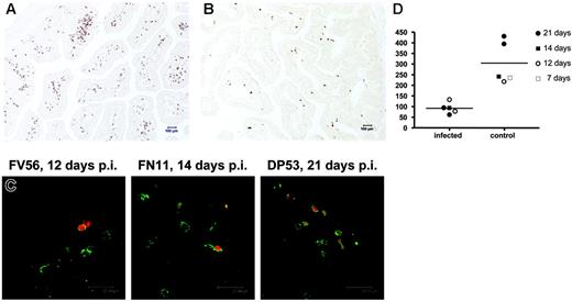 Figure 6. Immunohistochemistry using monoclonal antibody OPD4 demonstrating memory (CD45RO+) CD4+ T cells in the jejunum of an uninfected neonate (21 days old, DP53) and age-matched SIV-infected neonate (21 days after infection, EC73). Note that numerous memory CD4+ T cells are evident in the uninfected jejunum (A) as compared with the SIV-infected neonate (B). (C) Fluorescent in situ hybridization for SIV combined with immunofluorescence for OPD4 (CD4+ memory cells) in the intestine of 3 SIV-infected neonates examined 12 to 21 days after SIV infection. Essentially all of the SIV-infected cells (red) are CD4+CD45RO+ memory cells as defined by reactivity with monoclonal antibody OPD4 (green) using confocal microscopy. (D) Comparison of absolute numbers of CD4+CD45RO+ cells per square millimeter of jejunum lamina propria between SIV-infected and uninfected (control) neonates. Memory CD4+ T cells are markedly decreased in the intestine of all neonates as early as 12 days after SIV infection. Panels A and B were photographed using a Leica DM LB microscope (Leica Microsystems, Bannockburn, IL) with an N-planar 20×/0.40 NA objective equipped with a Spot 3.2.0 digital camera (Diagnostic Instruments, Sterling Heights, MI). Panel C was taken with a Leica TCS SP2 confocal microscope (Leica Microsystems, Exton, PA). NIH image version 1.62 (NIH, Gaithersburg, MD) and Adobe Photoshop (Adobe Systems, San Jose, CA) were used to assign colors to the images.