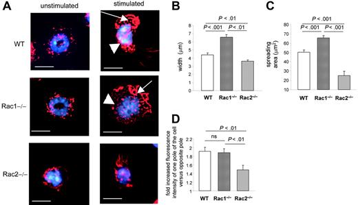 Figure 2. The loss of Rac1 activity leads to impaired uropod formation in neutrophils. WT, Rac1−/−, and Rac2−/− neutrophils were prestimulated with fMLP and seeded on anti-CD18–coated slides for 30 minutes. Some cells were seeded on noncoated slides for 30 minutes as negative control. The cells were then fixed and stained with rhodamine-phalloidin and mounted with reagent containing DAPI for nucleus. (A) Representative pictures of fluorescent images of F-actin (in red) for each genotype from 3 independent experiments. The nucleus is visualized in blue. The arrows point out the leading edge. The arrowhead points out the width of the tail. Note the presence of narrow lamellipodia and tail in WT cells, whereas Rac1−/− cells display a large lamelipodia and tail. Scale bar = 5 μm. (B) Quantification of body contraction by measuring the width of the cell (see “Materials and methods”). (C) Spreading area. (D) Cell polarity. The cells were divided into 2 equal transverse sections, and fluorescent intensity of F-actin was measured in arbitrary units. The results are expressed as fold-increased level of fluorescence of one pole of the cells compared with the opposite pole. Results show mean ± SEM.