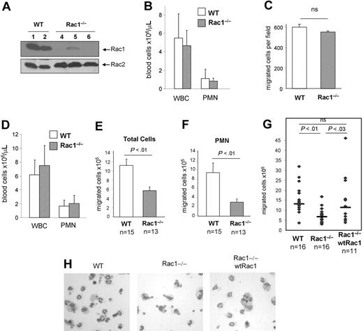 Figure 5. The loss of Rac1 activity induces a defect in neutrophil migration into the lung alveolar spaces. Mice reconstituted with WT or Rac1−/− hematopoietic cells were exposed to fMLP in the lung, and bronchoalveolar lavage was performed 24 hours after challenge. (A) Rac protein expression in bone marrow cells from WT or Rac1−/−-reconstituted mice was analyzed by immunoblot using antibodies specific for Rac1 or Rac2. (B) Blood was harvested, and white blood cell (WBC) count and neutrophil (PMN) count were enumerated with a hematologic analyzer for mouse blood sample. The histogram represents the total number of cells per microliter of blood. (C) Neutrophils were isolated from peripheral blood of mice reconstituted with WT or Rac1−/− hematopoietic cells after treatment with polyI:C. Neutrophil migration was analyzed using Boyden chamber in response to 1 μM fMLP. The result represents the number of migrated cells per field. (D) White blood cell counts and neutrophil counts at the time of killing, after fMLP challenge. (E) Total number of cells recovered in the BAL. (F) Total number of PMNs recovered in the BAL. Mean ± SEM from 3 independent experiments. (G) Mice reconstituted with WT, Rac1−/−, and Rac1−/− bone marrow cells expressing exogenous wtRac1 were challenged with fMLP. Cells recovered in BAL were counted by hemocytometer. Representation of individual mice; horizontal bars represent average. (H) Representative images of cytospin preparation of BAL of each group, ×400.
