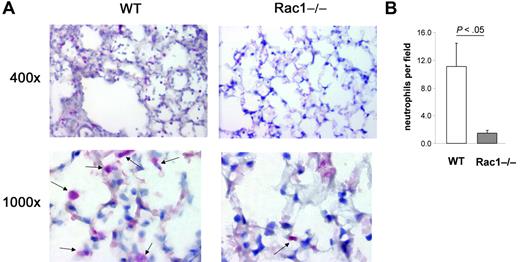 Figure 6. The loss of Rac1 activity induces a defect in neutrophil migration into the lung tissues. Mice reconstituted with WT or Rac1−/− hematopoietic cells were exposed to fMLP in the lung. Lungs were harvested 24 hours after challenge and fixed, and lung tissue was stained with Leder stain for neutrophil esterase. (A) Representative pictures of esterase-positive (pink) cells (see arrows) infiltrated into the lung. (B) Number of esterase-positive cells per field. Mean ± SD, n = 5.