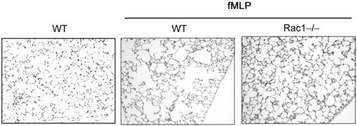 Figure 7. The loss of Rac1 activity reduces emphysema development. Mice reconstituted with WT or Rac1−/− hematopoietic cells were exposed to fMLP (20 μg per mouse) into the lung. WT non-exposed mice were used as control. Five weeks after exposure, lung histology was performed. Sections were stained with hematoxylin and eosin, ×200 (n = 16 from 2 independent experiments).