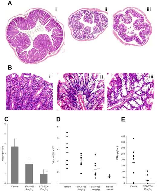 Figure 6. In vivo effects of STA-5326 in inflammatory bowel disease animal model. (A) Photomicrographs of representative H&E-stained colons in CD4+ CD45RBhigh T-cell–transferred SCID mice, acquired by Eclipse E800 microscope (Nikon, Tokyo, Japan). (Ai) vehicle control. (Aii) Mouse treated with STA-5326 at 10 mg/kg given orally. (Aiii) Normal control without cell transfer. The original magnification is equivalent to ×40 (4×/0.13 NA objective, 10× eyepiece) in all 3 photographs, this showing the greater colon size in the vehicle control colon relative to the STA-5326–treated colon and the control group without T-cell transfer. (B) Higher magnification (original, ×200; 20×/0.50 NA objective, 10× eyepiece) photomicrographs. (Bi) Vehicle control. (Bii) STA-5326. (Biii) Normal control. (C) Histologic scoring of the distal colon sections. The extent of colonic inflammation was graded on a scale of 0 to 3 in each of 4 criteria: crypt elongation, cell infiltration, depletion of goblet cells, and the number of crypt abscesses. Results shown are mean ± SEM histology scores for each group. The severity of STA-5326–treated mice was significantly reduced compared with the level of vehicle group (*P < .05). (D) Percentage of colon weight relative to body weight in CD4+ CD45RBhigh T-cell transfer SCID mice and normal control mice without cell transfer. Each dot represents an individual mouse, and the bar drawn in each group represents the mean value. **P < .01 compared with the level of the vehicle group. (E) IFN-γ produced from LPMCs after stimulation by anti-CD3/anti-CD28 antibodies. LP lymphocytes were isolated from freshly obtained colonic specimens, and stimulated with immobilized anti-CD3ϵ antibody and soluble anti-CD28 antibody. Culture supernatants were assayed for IFN-γ production. Each dot represents an individual mouse, and the bar drawn in each group represents mean value. *P < .05 compared with the level of the vehicle group.