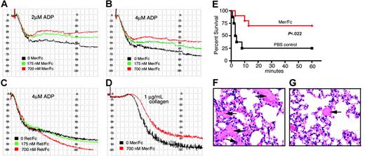 Figure 7. Mer extracellular domain inhibits platelet aggregation induced by ADP and collagen and protects mice against collagen-epinephrine–induced thrombosis. (A-D) In vitro platelet aggregation was performed using human PRP and was analyzed on a BioData aggregometer. (A-B) Aggregation response of platelets in response to 2 μM ADP (A) or 4 μM ADP (B) following preincubation with different concentrations of Mer/Fc. (C) Platelet aggregation induced by 4 μM ADP after pretreatment with Ret/Fc. (D) Aggregation of platelets in response to 10 μg/mL collagen with and without preincubation with Mer/Fc. Squares on the x-axis represent 15-second intervals. Data shown are representative of 3 independent experiments. (E) Survival of mice pretreated with Mer/Fc (n = 10) or saline (PBS control, n = 8) after collagen-epinephrine injection. Protection from fatal thromboembolism by Mer/Fc was significant (P < .022, log-rank test). (F-G) Hematoxylin and eosin staining of lungs from control mouse (F) or Mer/Fc-pretreated mouse (G) after collagen-epinephrine injection. Extensive platelet thromboembolism is seen in control mice (arrows) compared to the Mer/Fc-pretreated mice. Scale bar represents 100 μm.
