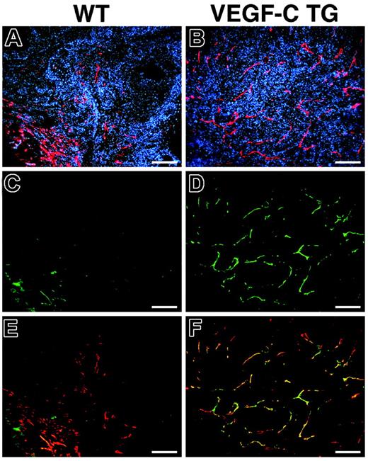 Figure 4. Increased expression of VEGFR-3 in tumor-associated lymphatic vessels of VEGFC transgenic mice. Immunofluorescence analysis of LYVE-1 (red) and VEGFR-3 (green) expression was performed in SCC samples from control (A,C,E) and VEGFC transgenic (TG; B,D,F) mice. Based on LYVE-1 expression, the SCCs of VEGFC transgenic mice demonstrated prominent lymphangiogenesis (B), whereas tumor-associated lymphatic vessels were less pronounced in SCCs of control mice (A). Expression of the VEGF-C receptor (VEGFR-3) was strongly up-regulated in the tumor-associated lymphatic vessels of VEGF-C–overexpressing mice (D). Merging of images revealed that VEGFR-3 expression completely colocalized with that of LYVE-1 (F, yellow to orange), whereas VEGFR-3 was only weakly expressed in the tumor-associated lymphatic vessels of control mice (C,E). (A-F) Scale bars represent 200 μm.