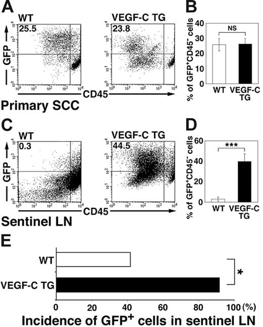 Figure 5. Increased tumor metastasis to sentinel lymph nodes in VEGFC transgenic mice. (A-D) Flow cytometry was used to calculate the percentage of GFP-expressing tumor cells in primary squamous-cell carcinomas (SCC; A-B) and in sentinel lymph nodes (LN; C-D) of control and VEGFC transgenic mice. Of all SCC-associated cells, 25.5% in the control GFP-transgenic mice and 23.8% in the VEGFC transgenic mice were observed to be GFP positive (A-B). Eight weeks after the first cutaneous SCCs were detected, the number and percentage of GFP-expressing tumor cells was significantly higher in metastases that formed in the sentinel lymph nodes of the VEGFC transgenic mice (44.5%) than of the control GFP-transgenic mice (0.3%; C). Data are expressed as mean ± SEM (n = 5 per group). (E) Fluorescence microscopy analysis revealed an increased incidence of sentinel lymph node metastasis in VEGFC transgenic mice, compared with control mice (n = 12). (B,D,E) ***P < .001; *P < .05; NS = no significance.