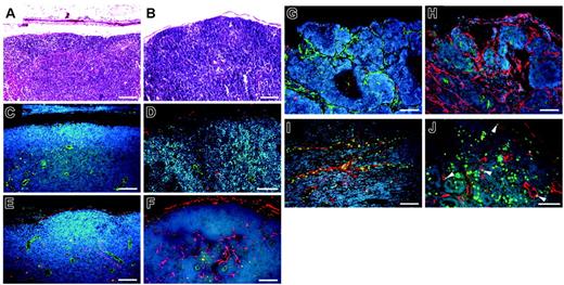 Figure 6. Prominent lymph node lymphangiogenesis in VEGFC transgenic mice. (A-B) Routine H&E stains of lymph nodes of non–tumor-bearing mice. (C-D) Double immunofluorescence staining of lymph nodes of non–tumor-bearing mice demonstrated a comparable pattern of CD31+/LYVE-1–negative blood vessels (green) and LYVE-1–positive sinusoids (red) in wild-type mice (C) and in VEGFC transgenic (TG; D) mice. Nonmetastatic sentinel lymph nodes of SCC-bearing VEGFC transgenic mice have increased numbers of enlarged LYVE-1–positive sinusoids (red; F), compared with control mice (E). An increased number of enlarged LYVE-1–positive lymphatic vessels (red) was also found in the metastatic sentinel lymph nodes of VEGFC transgenic mice (H), compared with control mice (G). The tumor-associated LYVE-1–positive vessels (red) in VEGFC transgenic mice showed high levels of BrdU staining in lymphatic endothelial cells (J; green), indicating active lymphatic proliferation (arrowheads) within sentinel lymph nodes. These cells also expressed Prox1 (I; green). Nuclei are stained blue (Hoechst stain). (A-F, I-J) Scale bars represent 100 μm; (G-H) scale bars represent 200 μm.