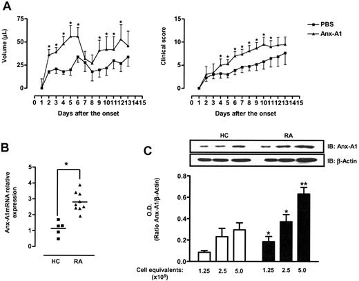 Figure 6. Anx-A1 and T cells in arthritis. (A) Paw volume and clinical score of DBA mice treated with PBS (100 μL) or hrAnx-A1 (1 μg subcutaneously twice a day) for 12 days during the immunization phase of the CIA model. Synchronization of disease onset was obtained by boosting with collagen on day 21, with clinical signs being evident from day 22 (day 1 of the onset of the diseases). Values are the mean ± SE of 6 to 8 mice. Groups were compared using the Mann-Whitney test. *P < .01. (B) Analysis of Anx-A1 expression in CD4+ cells of healthy control volunteers (HC) or patients with rheumatoid arthritis (RA). The median values are indicated by horizontal lines and P values of the Mann-Whitney test are shown. *P < .01. (C) Western blot analysis of Anx-A1 and β-actin levels in CD4+ cells of healthy control volunteers (HC) or patients with rheumatoid arthritis (RA). Results are representative of 5 different HCs or patients with RA. The bars represent the mean ratio ± SE of the optical density (OD) of Anx-A1 and β-actin bands from 5 different individuals. **P < .01.