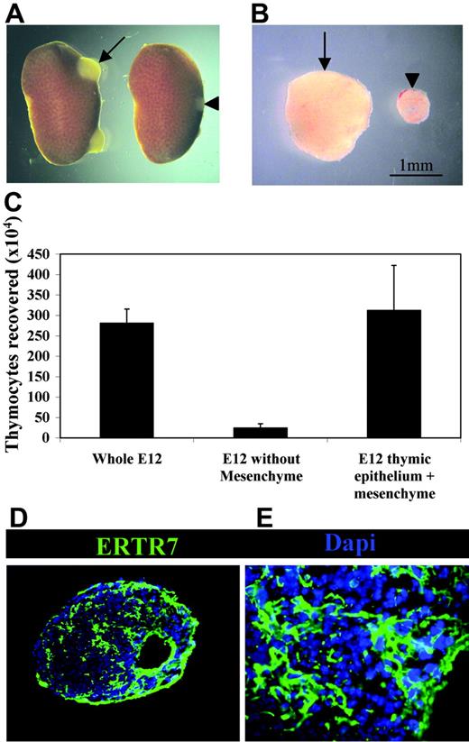 Figure 5. PDGFRα-expressing fetal mesenchyme regulates thymus growth and the availability of intrathymic niches. (A) Kidneys excised from mice that 3 weeks earlier received either whole unmanipulated (arrow) or mesenchyme-stripped (arrowhead) E12 thymus grafts under the renal capsule. Note the increased growth achieved in unmanipulated versus stripped thymus grafts (B). Importantly, grafts formed from epithelial cores reassociated with mesenchyme prior to transplantation were found to grow and contain similar thymocyte numbers in a manner comparable with unmanipulated thymus lobes. Grafts of unmanipulated of mesenchyme-stripped thymus lobes were analyzed for either thymocyte cellularity (C) or by immunohistochemistry using ERTR7 to identify host-derived mesenchyme that had invaginated the graft (D-E). Data shown are typical of 3 separate experiments. Results are averaged from at least 3 independent experiments, and are presented with standard deviations (error bars).