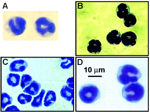 Figure 1. Photomicrographs of leukocytes characterized as basophils in 4 recently published studies. (A) FcϵRI+ IL-4–expressing FSClo/SSClo cells recovered from the lungs of N brasiliensis–infected mice (BALB/c) stained with Wright-Giemsa (from Voehringer et al5(Fig 1B); reprinted with permission from Elsevier. (B) IL-4–expressing DX5 (CD49b)+ non-CD4+ T cells from the liver of N brasiliensis–infected mice (BALB/c) stained with Wright-Giemsa (from Min et al3(Fig 3B); reproduced from The Journal of Experimental Medicine, 2004, 200:507-517, by copyright permission of The Rockefeller University Press). (C) FcϵRI+ IL-4–expressing CCR3− cells recovered from the blood of naive mice (BALB/c) stained with Wright-Giemsa (from Gessner et al4(Fig 3C); copyright 2005, American Association of Immunologists, Inc). (D) FcϵRI+/DX5+ bone marrow cells recovered from normal C57BL/6J mice stained with Giemsa (from Mukai et al2(Fig 5C); copyright 2005, reprinted with permission from Elsevier.)