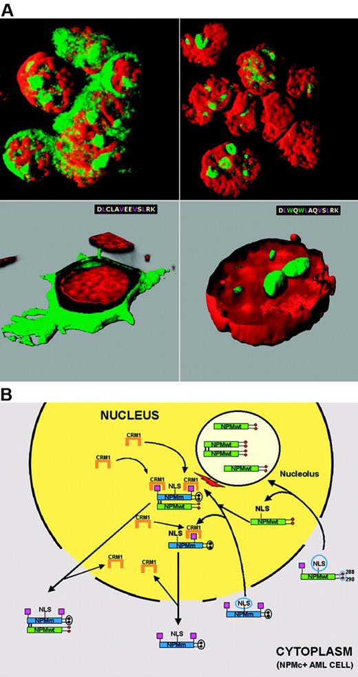 Figure 6. Mechanism of perturbed NPM nucleocytoplasmic traffic in NPMc+ AML. (A) Cytoplasmic accumulation of NPM is NES-dependent. OCI-AML3 cell line carrying the NPM1 mutation A shows cytoplasmic (and nucleolar) positivity for NPM (green) (top, left). NPM is relocated into the nucleus after exposure to the Crm1 inhibitor leptomycin B (top, right). Cytoplasmic accumulation of NPM is tryptophan dependent. In NIH-3T3 cells, NPM mutant A is relocated from cytoplasm (green, bottom, left) into nucleoli (green, bottom right), after the 2 tryptophans (W) are reinserted at positions 288 and 299. Images were collected with a Zeiss LSM 510 confocal microscope using a Plan Apochromat 100×/1.4 NA oil objective and LSM 5 software for image acquisition. Nuclei were stained with propidium iodide (Molecular Probes). Three-dimensional reconstruction of the confocal images and electronic cuts of cells were performed with Imaris software. (B) Hypothetical mechanism of altered nucleocytoplasmic traffic of NPM mutant A and NPMwt. Green boxes indicate NPMwt protein; blue boxes, mutated NPM protein; red circles, tryptophan residues; black circles, mutated tryptophans; magenta boxes, NES motif; and NLS, nuclear localization signal.