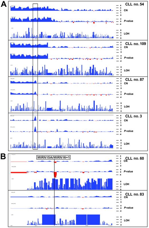 Figure 3. Copy number profiles of chromosome 2 and 13 in 6 CLL patients. The x-axis shows physical position along the chromosome. Red and blue colors indicate copy number loss and gain as well as the −log10 copy number–associated P value in the top and middle panels, respectively. The y-axis (bottom panel) indicates −log10 P value that homozygous stretches are due to chance. (A) Copy number and LOH profiles of 4 CLL patients with gains of chromosome 2p. Black rectangle indicates smallest region of overlap among the 4 aberrations. This gain of 3.5 Mb in patient no. 3 spans the REL and BCL11A oncogenes. (B) Copy number and LOH profile of chromosome 13 in 2 patients. Top panel shows biallelic deletion of the 13q14 region and LOH for almost the whole chromosome, indicative of a somatic recombination event. Due to the presence of normal cells, the LOH profile is not uniform because heterozygous SNP calls are still present and prevent more significant values. Bottom panel shows a profile of chromosome 13 with normal copy number but 3 large LOH regions totaling up to 40 Mb. The more proximal LOH spans the MIRN genes from the 13q14 region. These LOH regions are also present in the germline from this patient.