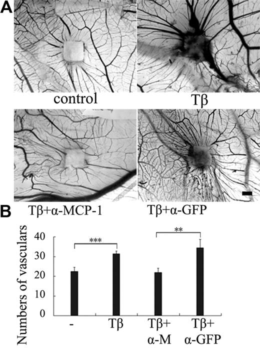 Figure 2. MCP-1 mediates TGF-β–induced angiogenesis. (A) The CAM assay was used to examine angiogenesis. Sterile 0.25 × 0.25-cm2 filter papers soaked with TGF-β1 (5 ng/mL) or together with anti-MCP-1–neutralizing antibody or anti-GFP antibody (200 ng/mL) were applied onto the surfaces of the growing CAMs. Physiologic saline was used as negative control. After incubation for 3 days, the CAMs were fixed and the photos were taken by microscopy. The area with increased opacity indicates an inflammatory response. Bar indicates 1 mm. (B) Quantitation of the newly formed blood vessels (n = 8). Eight to 10 eggs were used for each data point. Significant differences were measured by mean vascular numbers between control and TGF-β–treated CAM (***P < .001) and between α-MCP-1 and α-GFP antibody treatment (**P < .01). Error bars indicate SD.