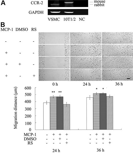 Figure 4. Inhibition of CCR2 activity blocks MCP-1–induced VSMC migration. (A) MCP-1 receptor CCR2 was expressed in VSMCs and 10T1/2 cells. Total RNAs were isolated for RT-PCR using primers for rabbit and mouse CCR2, respectively, or GAPDH (as control). The data are representative of 3 individual experiments. Negative control (NC) had no cDNA templates. (B) The confluent VSMC monolayers were wounded by scraping and treated with MCP-1 (10 ng/mL) or together with RS-102895 (300 nM) in serum-free medium. DMSO was the solvent of RS-102895. Cell migration to the wound surface was monitored from 0 to 36 hours. A representative was shown (bar represents 200 μm) and the migrated distance of the wound edge quantitated (bottom panel). Asterisks indicate a significant difference of migrated distance compared with the control (*P < .05, **P < .01; n = 3). Error bars indicate SD.