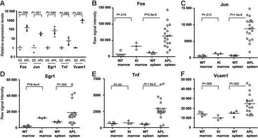 Figure 6. Common pathway gene expression patterns in leukemic and nonleukemic hematopoietic tissues. (A) qRT-PCR analysis of Fos, Jun, Egr-1, Tnf, and Vcam1 expression levels was performed using primers specific for each cDNA. All data were normalized to Gapdh, since the expression of this gene does not change during myeloid differentiation (Figure 5C). Day-2 samples were obtained from 2 independent myeloid differentiation experiments. The 6 APL samples used were the same as those used in the studies shown in Figures 4–5. All RNA samples used for this study were nonamplified. (B-F) Common pathway gene expression patterns in whole bone marrow and spleen samples using nonamplified RNA- and array-based expression profiling. Two grouping variable category graphs show raw probe set signal intensity values for the common pathway genes identified in Figure 5. Unmanipulated bone marrow and spleen samples were obtained from either wild-type mice (WT), or from mCG-PML-RARα mice (KI), and were cryopreserved prior to analysis. APL samples were obtained from the cryopreserved spleens of 18 overtly leukemic mCG-PML-RARα mice, including the 6 APL samples in Figures 3C, 4, and 5 (Table S2, APL samples 1-18).