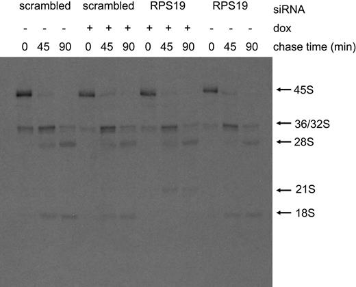 Figure 3. Pulse-chase analysis demonstrates abnormal pre-rRNA processing in TF-1 cells depleted of RPS19. Pulse-chase was carried out as described in “Materials and methods.” TF-1 cells infected with lentiviruses containing either siRNA B targeted to RPS19 (RPS19) or a scrambled siRNA (scrambled) were grown for 4 days in the presence (+) or absence (−) of DOX. Chase periods are shown above each lane.