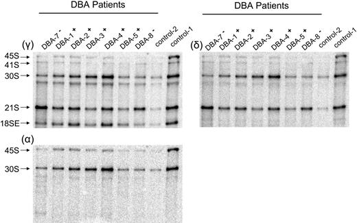 Figure 5. Northern blot analysis of CD34− BM cells reveals abnormal pre-rRNA processing in patients with DBA who have mutations in RPS19. Total RNA was isolated from CD34− cells and prepared for Northern blot analysis as described in Figure 2. Panels are designated according to oligonucleotides used for hybridization. Patients with DBA who have mutations in RPS19 are designated DBA-7− and DBA-8−, while patients with normal RPS19 are designated DBA-1+ to DBA-5+. Samples from DBA patients labeled DBA-7− and DBA-8− have a chromosome breakpoint mutation in RPS19 and a complete deletion of RPS19, respectively. Ratios listed in Table 1 are derived from phosphorimage analysis of signals for the RNA species listed. Not all samples listed in Table 1 are shown in here.