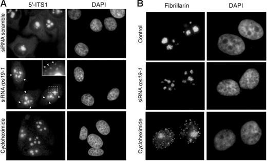 Figure 3. RPS19 depletion results in nuclear retention of pre-40S particles.(A) HeLa cells were transfected with different siRNAs, as indicated, and grown for 24 hours. The intracellular location of the 18S rRNA precursors was then analyzed by FISH using the 5′-ITS1 probe conjugated to Cy3. In rps19-1 siRNA-treated cells, accumulation of 18S rRNA precursors in the nucleoplasm is indicated by arrows; the inset shows the boxed region at higher magnification. Comparison is made with cells treated for 24 hours with 100 μg/mL cycloheximide. (B) Detection of fibrillarin, a nucleolar protein, by immunofluorescence. Cells were treated with cycloheximide or transfected with the rps19-1 siRNA as in panel A. “Control” indicates untreated cells.