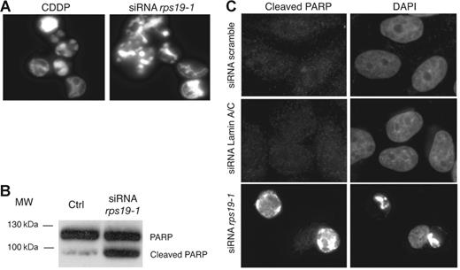 Figure 4. Apoptosis in HeLa cells transfected with rps19 siRNAs. (A) DAPI staining of cells detaching from the culture dish 48 hours after transfection with siRNA rps19-1 shows hypercondensed chromatin, similar to treatment with 10 μM cis-platin (CDDP) for 24 hours. (B) Immunodetection of the 85 kDa fragment of cleaved PARP on Western blot. “Ctrl” indicates untransfected cells. (C) Cleaved PARP is detected by immunofluorescence in RPS19-depleted cells but not in cells transfected with scramble or lamin A/C siRNAs.
