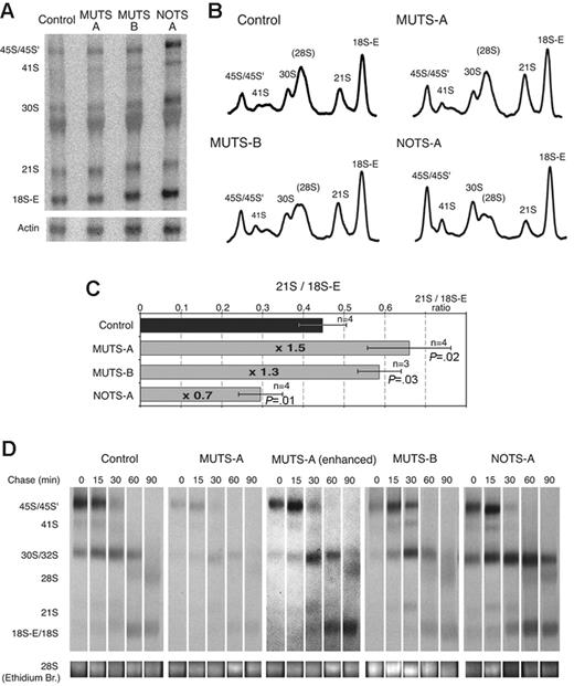 Figure 5. Alterations of pre-rRNA processing in skin fibroblasts from DBA patients. (A) Northern blot analysis of total RNA extracts from control and DBA fibroblasts with the 5′-ITS1 probe. The β-actin mRNA is detected as a loading control. (B) Intensity profiles of the hybridization signal in each lane (phosphoimaging) normalized to the level of actin mRNA. (C) Variation of the relative levels of 21S and 18S-E pre-rRNAs as compared with control cells. The amounts of the 2 species were measured after Northern blotting with the 5′-ITS1 probe by phosphoimaging. The results were analyzed with the Student t test. Error bars indicate standard deviation; n, number of experiments. (D) Pulse-chase analysis of pre-rRNA processing with 3H-methylmethionine. The cells were labeled for 30 minutes with 3H-methylmethionine, and chase was performed for the indicated time. Contrast in the panel corresponding to MUTS-A cells was enhanced by image processing (“enhanced”). All other panels correspond to identical exposure and processing. The 28S rRNA is shown as a loading control.