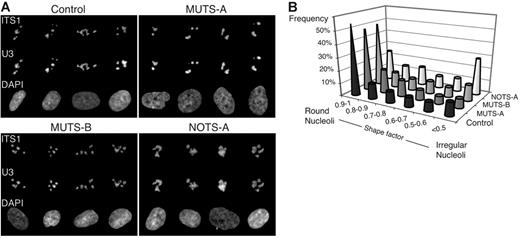 Figure 6. Nucleolar disorganization in skin fibroblasts from DBA patients. (A) Galleries of nuclei after codetection by FISH of the U3 snoRNA and the precursors to the 18S rRNA. Hybridization was performed in parallel with probes complementary to U3 (conjugated to Cy5) and to the ITS1 (conjugated to Cy3). (B) Distribution of the shape factor calculated for the nucleoli. This factor (4π.S/P2; S, surface; P, perimeter) reflects the structure roundness: Its value is equal to 1 for a circle and decreases for flat or irregular objects. The nucleolar shape is much more irregular in NOTS-A cells when compared with control cells (Student t test, P < .001).