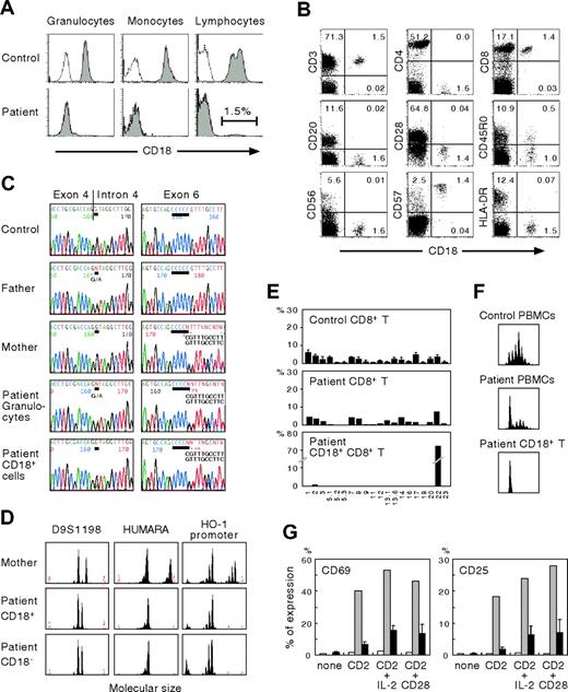 Figure 1. Characterization of CD18 expression, ITGB2 gene mutations, T-cell receptor repertoire, and T-cell functions. (A) Analysis of CD18 expression. Shown are the results of CD18 expression on granulocytes, monocytes, and lymphocytes. Open peaks indicate control Ab; solid peaks represent anti-CD18 mAb. (B) CD18 expression on the patient's lymphocyte subsets. The percentage of cells gated in each quadrant is shown. (C) Mutation analysis. The ITGB2 gene was amplified from DNA extracted from normal PBMCs, PBMCs from the parents, and the patient's granulocytes and CD18+ T cells. Direct sequencing was performed using an automated sequencer. Bars show the locations of the mutations. (D) Microsatellite analysis. Three different markers were amplified with FAM-labeled specific primers and subjected to GeneScan analysis. HUMARA indicates human androgen receptor gene; HO-1, heme oxygenase-1. (E) Expression profiles of TCR VB subfamilies. Peripheral blood samples were stained with mAbs for individual TCR VB subfamilies together with anti-CD8 and anti-CD18 mAbs. The expression of each TCR VB by CD8+ or CD18+CD8+ T cells was analyzed by FACS. (F) CDR3 spectratyping. A TCR VB22 fragment was amplified from cDNA with specific primers. The size distribution of polymerase chain reaction products was determined by GeneScan analysis. (G) Analysis of CD2-mediated T-cell activation. PBMCs from healthy control subjects and the patient were cultured for 16 hours with a combination of anti-CD2 mAbs alone or together with interleukin-2 or anti-CD28 mAb. CD69 and CD25 expression was evaluated in the patient's CD18−CD8+ T (□) and CD18+CD8+ T (⊡) cells. ▪ indicate control CD8+ T cells from healthy adults. Error bars represent SD.