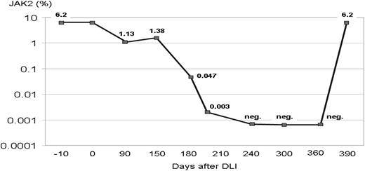 Figure 2. Kinetics of JAK2 mutations in a patient who received DLI for persistence of JAK2 mutation. Due to persistence of JAK2-V617F–positive cells, patient 20 received 1 × 106 CD3+ cells/kg as DLI. He experienced mild GVHD and became JAK2-V617F negative, but relapsed 1 year after DLI.