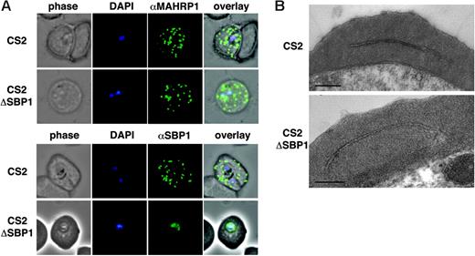 Figure 2. Structure and trafficking to Maurer clefts. (A) Localization of the resident Maurer clefts markers PfSBP1 and PfMAHRP1 in parental CS2 (first row of each panel) and CS2ΔSBP1-infected cells (second row of each panel). PfMAHRP1 was correctly trafficked to Maurer clefts in both cell lines, whereas PfSBP1 showed only cross-reactivity with another protein within the parasite CS2ΔSBP1 without localization on Maurer clefts as observed in the parental CS2 cells. (B) Ultrastructural analysis of CS2- (top) and CS2ΔSBP1-infected cells (bottom) shows typical Maurer clefts in both cell lines. Bars represent 0.5 μm.