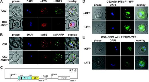 Figure 6. PfEMP1 cannot be loaded onto Maurer clefts in CS2ΔSBP1 transgenic cells. (A) Immunofluorescence study to assess trafficking of PfEMP1 in erythrocytes infected with parental CS2 and CS2ΔSBP1. Parental cells probed with anti-ATS and anti-SBP1 antibodies showed typical PfEMP1 localization in Maurer clefts in the erythrocyte (first row of panel), whereas PfEMP1 was accumulated in the parasite surrounding parasitophorous vacuole in CS2ΔSBP1-infected cells (second row of panel). Arrowheads show colocalization. DAPI was used to stain the nuclear DNA in all panels. (B) Colocalization with anti-ATS and anti-MAHRP antibodies to Maurer clefts is shown in parental CS2-infected erythrocytes (first row of panel, arrowheads), whereas in the CS2ΔSBP1-infected cells there is no overlap of the 2 proteins in Maurer clefts. (C) Schematic representation of the plasmid to express a truncated PfEMP1 fused to YFP. The PfEMP1-YFP gene is flanked by an hsp86 promoter and a PbDT 3′ terminator. Blasticidin-S deaminase is used as a selection cassette. (D) Expression of PfEMP1-YFP in CS2 wild-type– and CS2ΔSBP1-infected erythrocytes are shown by anti-GFP labeling. In erythrocytes infected with parental CS2 (first row, top panel), the PfEMP1-YFP fusion is localized in the parasite, but the majority of the protein is transported into the erythrocyte cytosol and shows a characteristic Maurer clefts staining. In the CS2ΔSBP1-infected erythrocytes (first row, bottom panel), however, the fusion protein can only be detected within the confines of the parasitophorous vacuole. Both cell lines were also probed with anti-ATS antibody to check for possible trafficking defects caused by the YFP chimera (bottom panels).