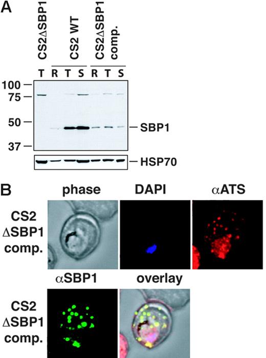 Figure 7. CS2ΔSBP1-complemented transgenic cells export PfEMP1 beyond the parasitophorous vacuole. (A) Western blot showing expression of SBP1 in different stages of CS2WT and CS2ΔSBP1-complemented cells. Saponin pellets of erythrocytes infected with ring- (R), trophozoite- (T), and schizont-stage (S) CS2WT and CS2ΔSBP1-complemented parasites were loaded to detect the level of expression of SBP1. For each cell line, samples were taken from the same culture dish at different time points. The blot was stripped and reprobed with HSP70 to show the amount of parasite material loaded. The cross-reactive band at 80 kDa is shown for the same purpose. Saponin pellet of CS2ΔSBP1 trophozoite-infected erythrocytes was loaded as a control. (B) Immunofluorescence assay to assess trafficking of PfEMP1 in erythrocytes infected with CS2ΔSBP1-complemented parasites. Cells were probed with anti-ATS antibody showing typical PfEMP1 localization with protein detectable within the parasite and in prominent punctate structures in the erythrocyte. These structures were shown to colocalize with the Maurer clefts protein SBP1. The amount and timing of SBP1 expression is different in the CS2ΔSBP1-complemented cells because of the episomal expression under a different promoter. DAPI was used to stain the nuclear DNA.
