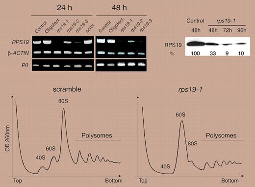 Down-regulation of RPS19 expression blocks maturation of the 18S rRNA. See the complete figure in the article beginning on page 1275.