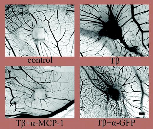 MCP-1 mediates TGF-β–induced angiogenesis. See the complete figure in the article beginning on page 987.