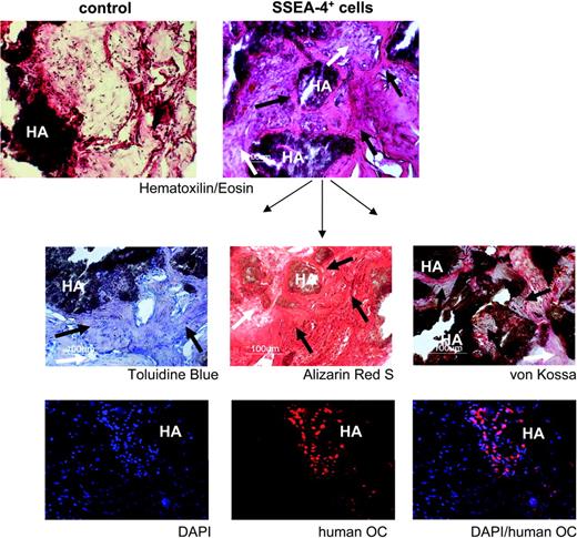 Figure 7. In vivo bone formation by prospectively isolated human MSCs. Tissue sections from a representative transplant, stained as indicated, are shown. HA indicates hydroxyapatite scaffold. For each panel, black arrows indicate new bone formation; white arrows, fibrous tissue. The lower 3 panels show immunohistochemistry for human osteocalcin (OC) in red and nuclear staining with DAPI in blue. Original magnification: 10×/0.3 NA Ph1 (top 2 panels), 20×/0.4 NA Ph1 (lower panels).