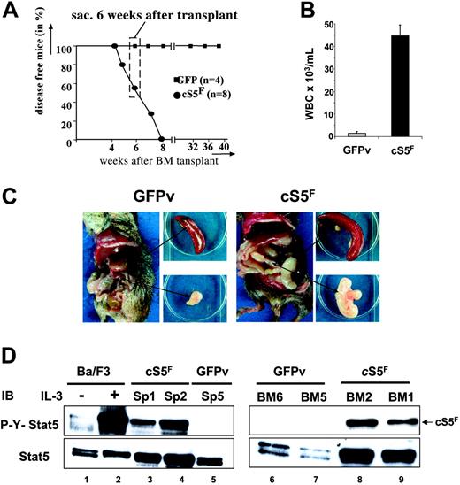 Figure 1. Leukemogenic mice that received a transplant of cS5F as a model to characterize the transforming properties of Stat5. (A) Kaplan-Meier plot of mice that received a transplant of cS5F (n = 8) versus mice that received a transplant of GFPv (n = 4). Mice that received a transplant of cS5F died within 7 weeks after transplantation, while control GFPv mice remain disease free (followed for more then 10 months after transplantation). Thus, experimental mice that received a transplant of cS5F were killed and analyzed 6 weeks after transplantation for all following experiments (dashed box). (B) White blood cell counts from mice that received a transplant of cS5F (n = 8) and from GFPv mice (n = 4). Error bars represent SE. (C) Typical organic alterations of mice that received a transplant of cS5F and control GFPv mice that were killed at 6 weeks after transplantation. Leukemic mice that received a transplant of cS5F have a unique pathologic appearance with massively enlarged mesenterial lymph nodes (lymphadenopathy) and splenomegaly. (D) Splenic- and BM-cell extracts from 2 mice that received a transplant of cS5F (Sp1, Sp2, BM1, BM2) or from control GFPv mice (Sp5, BM5, BM6) were analyzed by Western blotting with the indicated antibodies. Cell lysates from Ba/F3 cells unstimulated or stimulated with IL-3 for 30 minutes were also included as controls.