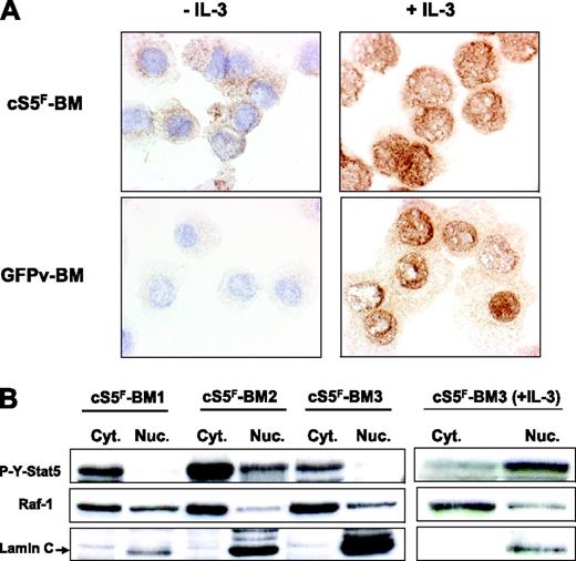 Figure 3. Cytoplasmic localization of cS5F in bone marrow cells. (A) Immunocytochemical detection of phosphorylated Stat5 in cS5F-expressing BM cells and control GFPv BM cells stimulated or not with IL-3. In each case, cells were spun on cytospin slides and analyzed by indirect immunocytochemistry using an anti–P-Y-Stat5 antibody (AX1). (B) The localization of cS5F was also determined by Western blot analysis using cytoplasmic and nuclear extracts of unstimulated or IL-3–stimulated cS5F BM cells from 3 different mice that received a transplant.