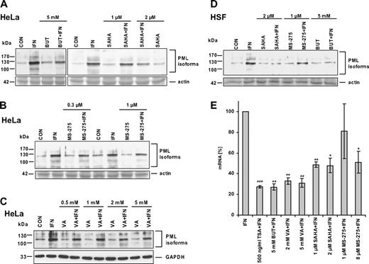 Figure 3. HDAC inhibitors differ in their ability to suppress IFNα induction of PML. Western blot analysis of PML protein levels in HeLa cells (A-C) or HSFs (D) simultaneously treated for 24 hours with IFNα and one of the following HDAC inhibitors: BUT, VA, SAHA, or MS-275. The final concentrations of the inhibitors are indicated. Cell protein lysates (25 μg total protein) were loaded on 8% SDS gels (actin band of Ponceau S–stained membrane or GAPDH signal is shown to demonstrate equal loading). (E) Real-time RT-PCR quantification of HDAC inhibitors' suppression of IFNα-induced PML mRNA. HeLa cells were treated with 1000 U/mL IFNα alone or simultaneously with a particular HDAC inhibitor for 8 hours. PML mRNA levels were normalized to GAPDH. Statistically significant differences compared with the IFNα-treated cells are indicated by ***P < .001, **P < .005, or *P < .05; 3 independent experiments were evaluated. Error bars represent standard error.