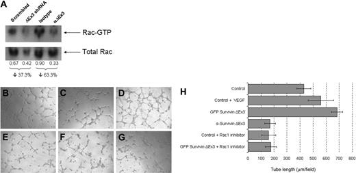 Figure 6. Survivin ΔEx3 is involved in Rac1 activation during endothelial tube formation. (A) HUVECs plated onto BME were analyzed for Rac1 activation at the tube formation stage (4 hours) by GST-PBD pull-down assays. The amount of active Rac1 was normalized against total Rac1 in the corresponding lysate, and the integrated density values of the bands were measured using Syngene GeneTools analysis software. (B-H) HUVE cells were plated on growth factor–reduced BME in 96-well plates supplemented with VEGF (20 ng/mL) or Rac1 inhibitor (100 μM), untransfected, or after transfection with eGFP Survivin ΔEx3. (B) Control; (C) control + VEGF; (D) GFP Survivin ΔEx3; (E) Survivin ΔEx3 antibody (10 μg/mL); (F) control + Rac1 inhibitor; and (G) GFP Survivin ΔEx3 + Rac1 inhibitor. Tube formation was assayed at 4 hours after plating on BME, and quantitative data were collected by measuring the length of the tubules formed under an inverted light microscope at ×100 magnification (40×/0.75 objective lens). Quantitative data shown in panel H are mean ± SE of 5 replicates per sample.