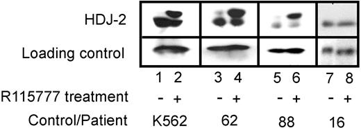 Figure 2. Effect of tipifarnib (R115777) on FTase-dependent processing of HDJ-2 in leukemic bone marrow samples. Heparinized bone marrow aspirates on day 0 (prior to tipifarnib treatment) and day 8 of therapy were fractionated on 2-step Ficoll-Hypaque gradients. Mononuclear cells were washed once with RPMI 1640 containing 10 nM HEPES (pH 7.4 at room temperature), counted, and solubilized for immunoblotting. Aliquots containing 50 μg total cellular protein were subjected to SDS-PAGE, transferred to nitrocellulose, and probed with monoclonal anti–HDJ-2 (Neomarkers, Fremont, CA). K562 cells treated with diluent or tipifarnib (R115777) served as negative and positive controls, respectively, for the presence of pre–HDJ-2.