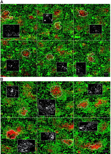 Figure 3. Montage of low magnification confocal images of spleen sections of LTα−/− mice. (A) LTα−/− mice. (B) Organization of the spleens of LTα−/− mice 10 days after transfer of CD4+CD3− cells. CD3 is shown in red and IgM in green. Yellow shows colocalization of B and T cells. Inset boxes show single staining for VCAM-1 (in white) in the T zones as outlined by white figures in main pictures. Scale bar represents 100 μm. Results representative of at least 2 separate experiments.
