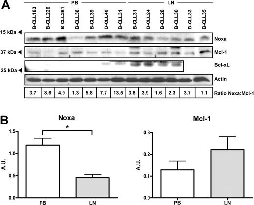 Figure 3. Comparison of Noxa, Mcl-1, and Bcl-xL protein in PB versus LN B-CLL. Protein lysates of 7 PB samples and 6 LN samples were subjected to Western blot analyses. (A) Blots were stained with antibodies directed against Noxa, Mcl-1, or Bcl-xL and reprobed with an antibody against β-actin as a loading control. In case of Bcl-xL, a specific staining at the upper cutting edge of the blot is visible and precluded analysis of the rightmost 2 samples. Densitometric scanning was performed, and Noxa/Mcl-1 ratios, corrected for actin levels, are indicated below the samples. The averaged Noxa/Mcl-1 ratio was significantly different between PB and LN (P = .011). (B) Averaged Noxa/actin and Mcl-1/actin ratios are separately plotted for PB and LN samples. Unpaired t test showed that Noxa ratios were statistically significant (P = .002), and Mcl-1 ratios showed a nonsignificant trend. Error bars indicate standard deviation.