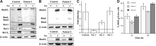 Figure 1. The induction of Bim expression during human T-cell blast generation is abolished in an ALPS-Ic patient but not in ALPS-Ia patients. Sensitivity to death by IL-2 deprivation. Anti–Mcl-1, anti–Bcl-2, anti–Bcl-xS, anti-Bim, or anti–β-actin immunoblots were performed on extracts from fresh peripheral-blood mononuclear cells (PBMCs) (day 0) or from day-6 T-cell blasts (day 6), obtained from healthy donors (Control) or from the ALPS-Ic patient 1 (A) or ALPS-Ia patients 2 and 3 (B), as indicated. The positions of Mcl-1, Bcl-2, Bcl-xS, BimEL, BimL, BimS, and β-actin are indicated on the left of the corresponding blots. The extracts used correspond to 1 × 106 cells, and expression levels of the proteins analyzed were quantified in a densitometer and normalized to the same amount of β-actin. The results obtained for the BimEL/β-actin ratios in fresh PBMCs and in day-6 T-cell blasts from the same donors allowed the calculation of the fold induction of Bim in each case, and results are depicted in panel C. Results are the mean ± SD from 10 different healthy controls and from at least 2 different experiments performed with the individual ALPS patients 1, 2, or 3, as indicated. (D) Day-6 T-cell blasts were incubated at 2 × 106 cells/mL for 24 or 48 hours in the absence of IL-2. Apoptosis was estimated by analyzing ΔΨm loss by DiOC63 staining and flow cytometry, and results were expressed as the percentage of DiOC63-low cells. Results are the mean ± SD of duplicate determinations using T cells from 4 different healthy controls and of 2 different experiments using T cells from the patients. The samples shown in each immunoblot were run in the same gel.