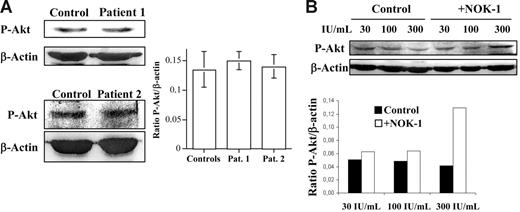 Figure 4. Normal phospho-Akt levels in T-cell blasts from ALPS patients. Role of FasL in controlling Akt activation. (A) Anti–phospho-Akt (P-Akt) or anti–β-actin immunoblots were performed on extracts from day-6 T-cell blasts, obtained from healthy donors (Control) or from ALPS-Ic patient 1 or ALPS-Ia patient 2, as indicated. (B) Day-6 T-cell blasts were cultured for an additional period of 48 hours in the presence of increasing doses of IL-2, as indicated, and in the presence (+NOK-1) or absence (Control) of 1 μg/mL of the anti-FasL–blocking mAb NOK-1. The extracts used correspond to 1 × 106 cells, and the levels of P-Akt were quantified in a densitometer and normalized to the same amount of β-actin. The results obtained for the P-Akt/β-actin ratios are shown in panels A and B. In panel A, results are the mean ± SD from 4 different healthy controls and from 2 different experiments performed with the individual ALPS patients, as indicated. In panel B, results are representative of experiments performed with T-cell blasts from 4 different healthy donors. The samples shown in each immunoblot panel were run in the same gel.