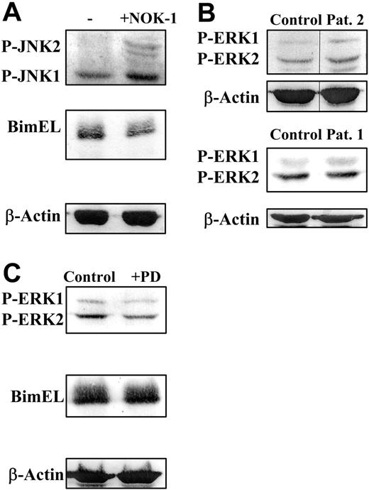 Figure 5. JNK and ERK are not the main pathways that control Bim levels in human T-cell blasts. (A) Day-6 T-cell blasts were cultured for an additional period of 48 hours in the presence of 30 IU/mL of IL-2 and in the presence (+NOK-1) or absence (−) of 1 μg/mL of the anti-FasL–blocking mAb NOK-1. (B) Day-6 T-cell blasts, obtained from healthy donors (Control) or from ALPS-Ia patient 2 or ALPS-Ic patient 1, as indicated, were analyzed without further incubation. (C) Day-6 T-cell blasts from healthy donors were cultured for an additional period of 24 hours in the presence of 30 IU/mL of IL-2 and in the presence of either 0.2% DMSO (Control) or 10 μM PD098059, as indicated. After the incubations described, cell extracts were obtained and anti–phospho-JNK1/2 (P-JNK1/2; A), anti-Bim (A,C), anti–phospho-ERK1/2 (PERK1/2; B-C), or anti–β-actin (A-C) immunoblots were performed. The extracts used correspond to 1 × 106 cells, and the levels of P-ERK1 or P-ERK2 were quantified in a densitometer and normalized to the same amount of β-actin (not shown). Results are representative of experiments performed with T-cell blasts from 3 different healthy donors. The samples shown in each immunoblot panel were run in the same gel. The vertical lines inside the top subpanels in panel B indicate that lanes were cut from the same immunoblot membrane.