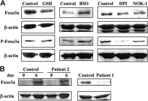Figure 7. H2O2 control Bim expression through regulation of Foxo3a levels in T-cell blasts. (A) Day-6 T-cell blasts were cultured in the presence of 30 IU/mL of IL-2 for 24 hours in the absence of any additional treatment (Control) or in the presence of 5 mM GSH, 400 μM BSO, 1 μM DPI, or 1 μg/ml of NOK-1, as indicated. After the treatments, the intracellular levels of H2O2 were determined by DCF-DA staining and flow cytometry, with similar percentages of increase or decrease as shown in Figure 6A (not shown), or extracts were obtained and anti-Foxo3a, anti–phospho-Foxo3a (P-Foxo3a), or anti–β-actin immunoblots performed. Results are representative of experiments performed with T-cell blasts from 4 different healthy donors. (B) Anti-Foxo3a or anti–β-actin immunoblots were performed on extracts from fresh PBMCs (day 0) or from day-6 T-cell blasts (day 6), obtained from healthy donors (Control) or from ALPS-Ia patient 2 (left panels), or from day-6 T cell blasts obtained from healthy donors (Control) or from ALPS-Ic patient 1 (right panels), as indicated. The extracts used correspond to 1 × 106 cells. Results are representative of experiments performed with T-cell blasts from 3 different healthy donors and of 2 different experiments performed with T cells from the ALPS patients. The vertical line in the left subpanel of panel B is due to smear of the sample, revealed in the immunoblot. The samples shown in each immunoblot panel were run in the same gel.