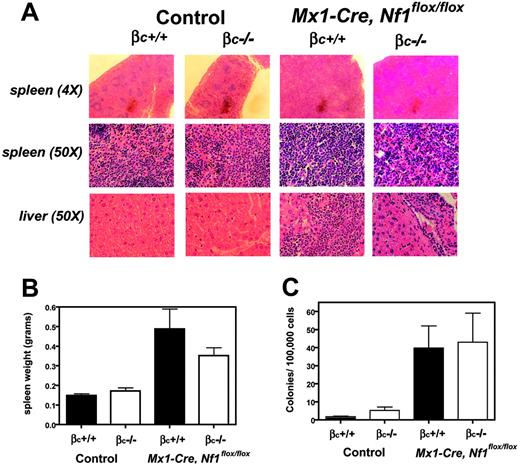Figure 5. Splenic infiltration in Mx1-Cre, Nf1 flox/flox, beta c−/− and Mx1-Cre, Nf1flox/flox, beta c+/+ mice. (A) Inactivation of Nf1 leads to increased numbers of myeloid lineage cells in spleen and liver, which is most pronounced in 6 Mx1-Cre, Nf1flox/flox, beta c+/+ animals and absent in 7 wild-type and 5 beta c−/− spleens. (B) Spleen weights in 7 control and 6 Mx1-Cre, Nf1flox/flox mice. Loss of Nf1 results in splenomegaly and is attenuated 6 Mx1-Cre, Nf1flox/flox, beta c−/− mice. (C) CFU-GM colony numbers from 4 individual experiments of mice of all 4 genotypes demonstrate infiltration in the Nf1 mutant animals.