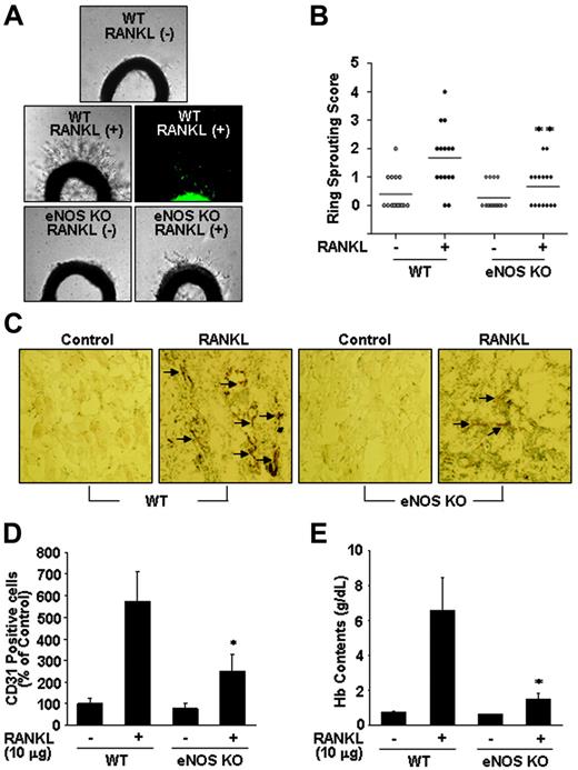 Figure 6. eNOS plays a critical role in RANKL-induced angiogenesis. (A) Aortic segments were harvested from WT and eNOS KO mice (n = 7 per group). Endothelial-cell sprouts forming branching cords from the margins of vessel segments taken from mice were photographed under a phase microscope. Staining of endothelial cells sprouted from RANKL-treated aorta with VWF (middle). (B) Sprouting scores were classified from 0 (least positive) to 5 (most positive). Data are means ± SEs. (C-E) WT and eNOS KO mice (n = 7 per group) were injected with 0.6 mL Matrigel containing RANKL (10 μg). After 7 days, the mice were killed and the Matrigel plugs were excised. (C) Plugs were stained for infiltrating endothelial cells using anti-CD31 antibody. Arrows indicate CD31+ cells. (D) Quantitative assessment of CD31+ endothelial cells. (E) Quantification of neovessel formation by measuring hemoglobin in the Matrigel. Data are means ± SDs; *P < .05; * *P < .01 versus RANKL in WT.