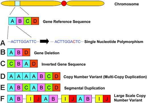 Figure 1. Genomic variation definitions. (A) A single nucleotide polymorphism (SNP) occurs as a result of a single base substitution at an individual site in the DNA sequence along the chromosome. Nonsynonymous coding SNPs occur in the coding region of a gene where the alternate SNP allele results in the coding of a different amino acid. (B) A deletion is the loss/absence of DNA sequence. (C) An inversion is a rearrangement causing a segment of DNA to be present in reverse orientation. (D) A copy number variant (CNV) is a segment of DNA that is 1 kb or larger and is present at a variable copy number in comparison with a reference genome. CNVs can be either deletion variants where there is loss of copy number relative to the reference sequence or multicopy duplications where there is gain of copy number relative to the reference sample. (E) A segmental duplication is a segment of DNA at least 1 kb in size that occurs in 2 or more copies per haploid genome, with the different copies sharing at least 90% sequence identity. (F) A large-scale copy number variant is a CNV that involves a segment of DNA more than 50 kb in size.