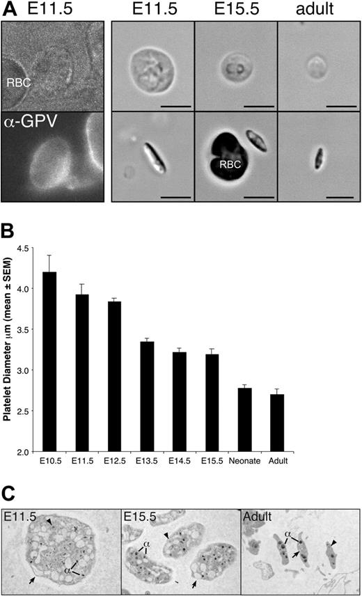 Figure 5. Large platelets circulate in the embryonic and fetal vasculature. (A) Platelet-enriched blood was stained with anti–GPV-FITC antibodies (E11.5 shown, left panel), which specifically label platelets but not red blood cells. Shown to the right are examples of platelets from E11.5, E15.5, and adult peripheral blood, depicting the broad face (top) and narrow side (bottom). Regardless of cell diameter, all platelets were narrow and biconvex. Scale bar equals 5 μm. (B) Mean platelet diameter (± SEM) in E11.5 to E15.5 fetuses, in neonates, and in adult mice. A minimum of 100 platelets was measured per peripheral blood sample and at least 3 independent samples were studied, except for E10.5, of which 2 pooled blood samples were examined and a total of 11 platelets was measured. (C) Transmission electron microscopic images of E11.5, E15.5, and adult platelets. All images taken at × 10 000. Open canalicular system (arrows), dense granules (arrowheads), and alpha granules (α) are evident.