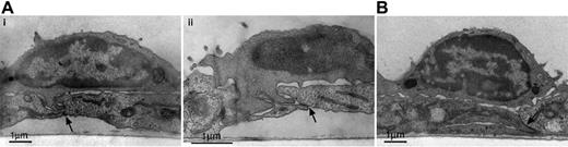 Figure 4. Shear stress applied on T cells approaching endothelial junctions trigger membrane protrusions within junctions and into neighboring endothelial cells. T cells locomotive on HUVECs in the presence of apical CXCL12 (10 ng/mL) and basal CCL5 (100 ng/mL) were subjected to continuous application of shear or to shear-free conditions (for 2 minutes), as described in “Materials and methods” (see also Figure 2). After 2 minutes, HUVEC monolayers and adherent T cells were immediately fixed and processed for transmission electron microscopy. (A, i-ii) Cross-sections of 2 representative T cells reaching endothelial junctions under continuous shear flow. (B) Representative T cell under shear-free conditions, showing contact over the junction without pseudopodial extensions. Arrows denote the endothelial junctions in each panel. Scale is indicated by the 1-μM bar in each panel. The magnification of panels A, B, and C is 11 000×, 16 000×, and 11 000×, respectively.