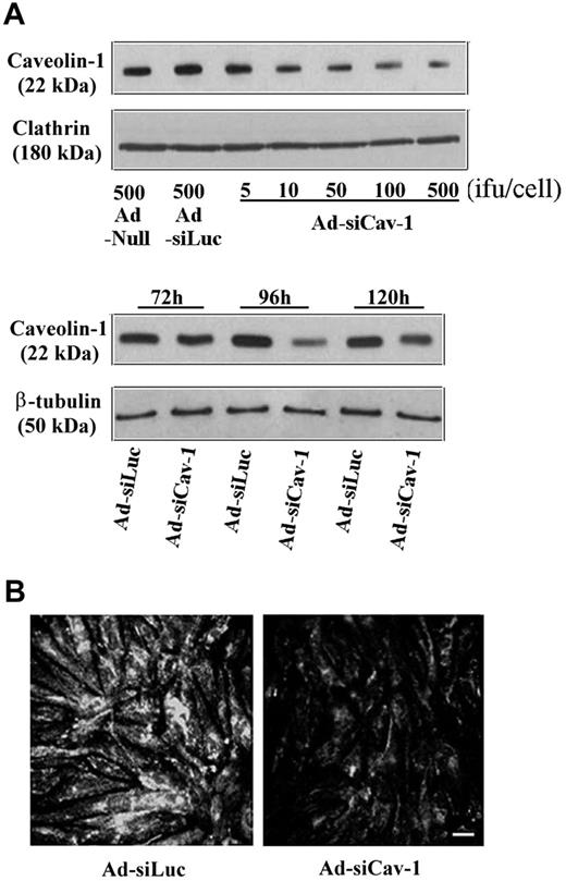 Figure 1. Ad-siCav-1 knocks down caveolin-1 expression in BMEC monolayers. Just subconfluent BMECs were transduced with Ad-siCav-1 as described in “Materials and methods.” (A) Western blotting showing dosage (top; 96 hours) and time course (bottom; 500 ifu per cell) effects of Ad-siCav-1 exposure. Ad-siLuc refers to an adenoviral construct expressing luciferase siRNA, which served as a control for Ad-siCav-1. An inoculum of 500 ifu per cell produced the most dramatic effect, which was achieved after 96 hours of viral exposure. (B) Immunofluorescent staining with antibody to caveolin-1 of BMEC monolayers transduced with Ad-siCav-1 (500 ifu per cell, 96 hours). A significant reduction in staining intensity is readily apparent. Scale bar represents 50 μm.